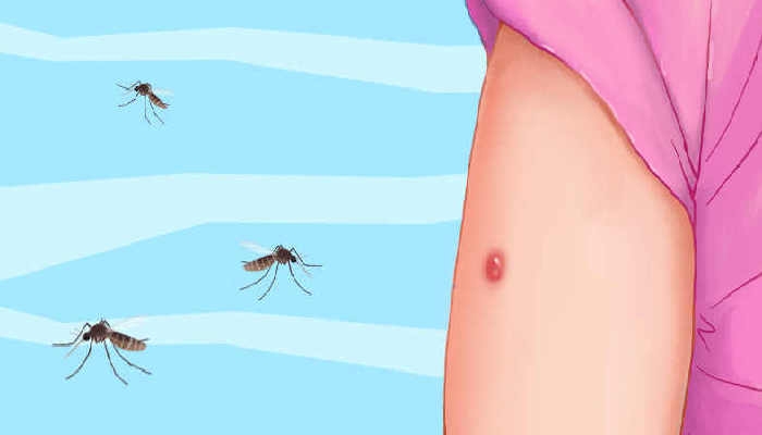 想要更稳准狠地打中蚊子最好怎么拍 怎么样才能更准的打中蚊子