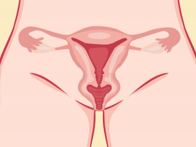 子宫内膜息肉和子宫肌瘤的区别