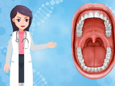 舌头乳头状瘤
