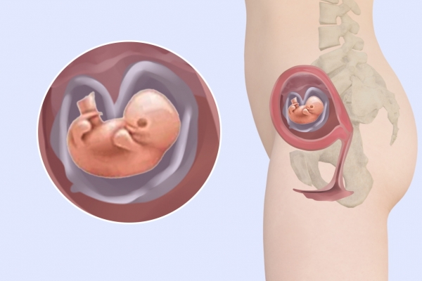 孕妇产下胎中胎的原因